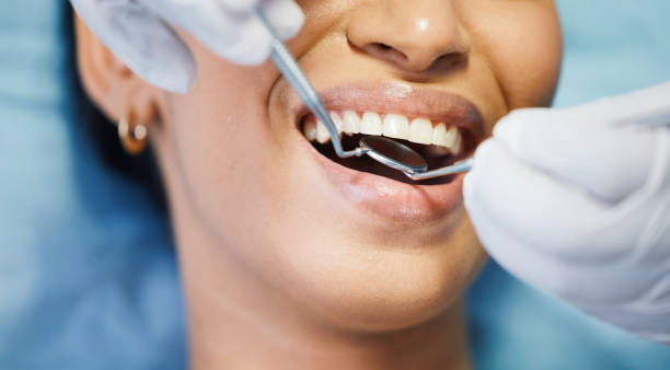 Best Emergency Dental Care for Broken or Chipped Teeth in Delta, UT